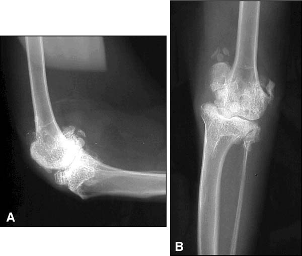 Luxation Patellaire chat